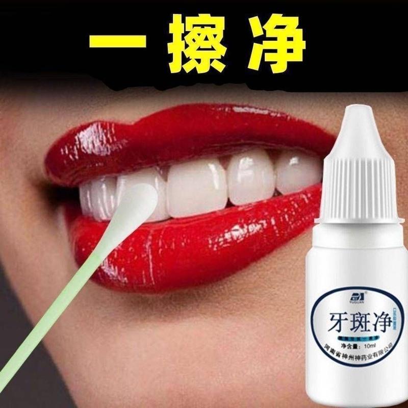 牙斑净去除烟渍牙斑黄牙黑牙结石速效美白牙齿脱色剂茶渍牙菌斑 两盒价格9.9