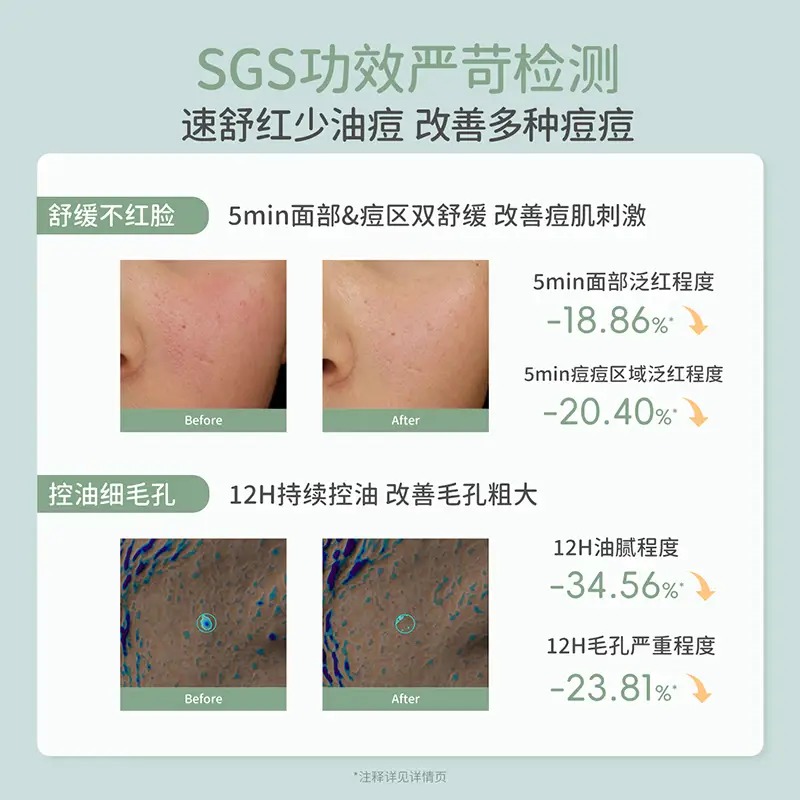 袋鼠妈妈-青少年安肌爽肤水2.0版-130ml高清大图