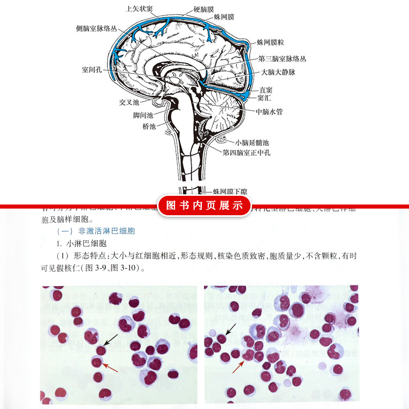 [醉染正版]脑脊液细胞学图谱及临床诊断思路许绍强 浆膜积液脑脊液检验诊断神经系统疾病鉴别诊断学脑静脉疾病医学症状诊断学临高清大图