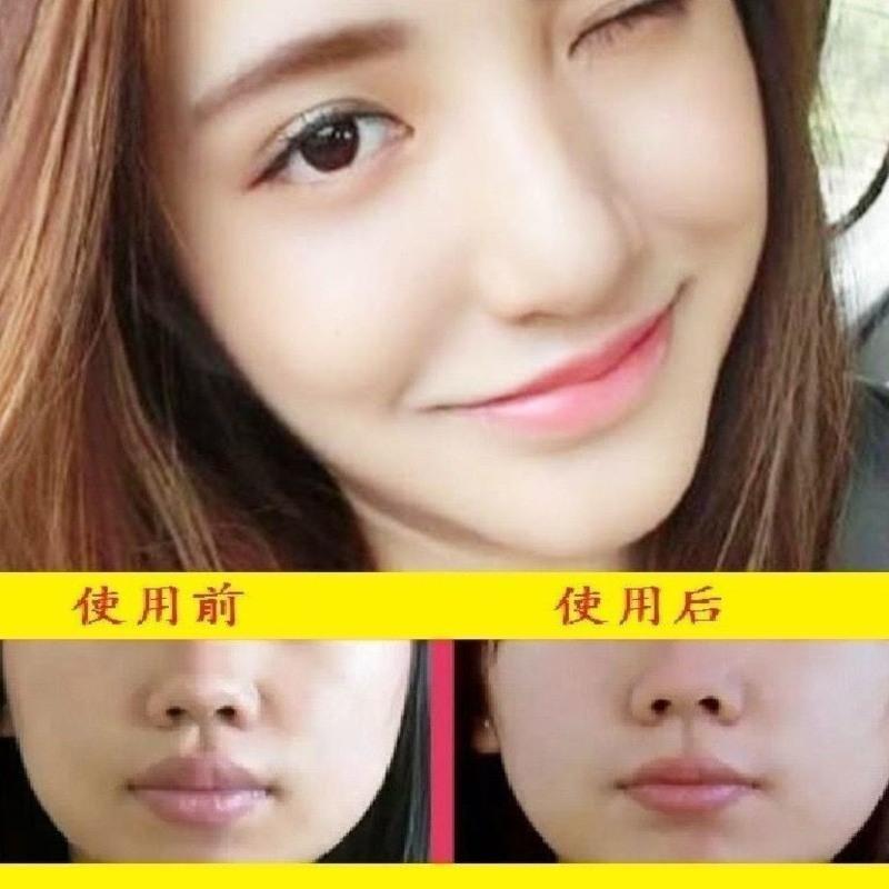 拓芙秘唇部 去嘴唇部去唇周边黑暗沉唇膜去黑色素嘴边学生嘴巴角唇纹精华护理
