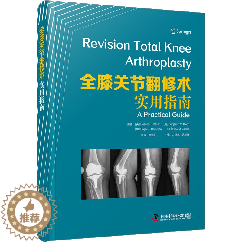 [醉染正版]全膝关节翻修术 实用指南 (英)霍萨姆·E.马塔尔 等 家庭保健 生活 中国科学技术出版社