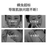 雪玲妃香皂芝士除螨皂洗脸皂洁面皂脸部面部女深层清洁男女100克