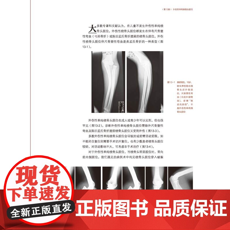 []积水潭医院创伤骨科治疗技术. 肘关节骨折(积水潭骨折治疗系列第3册)高清大图