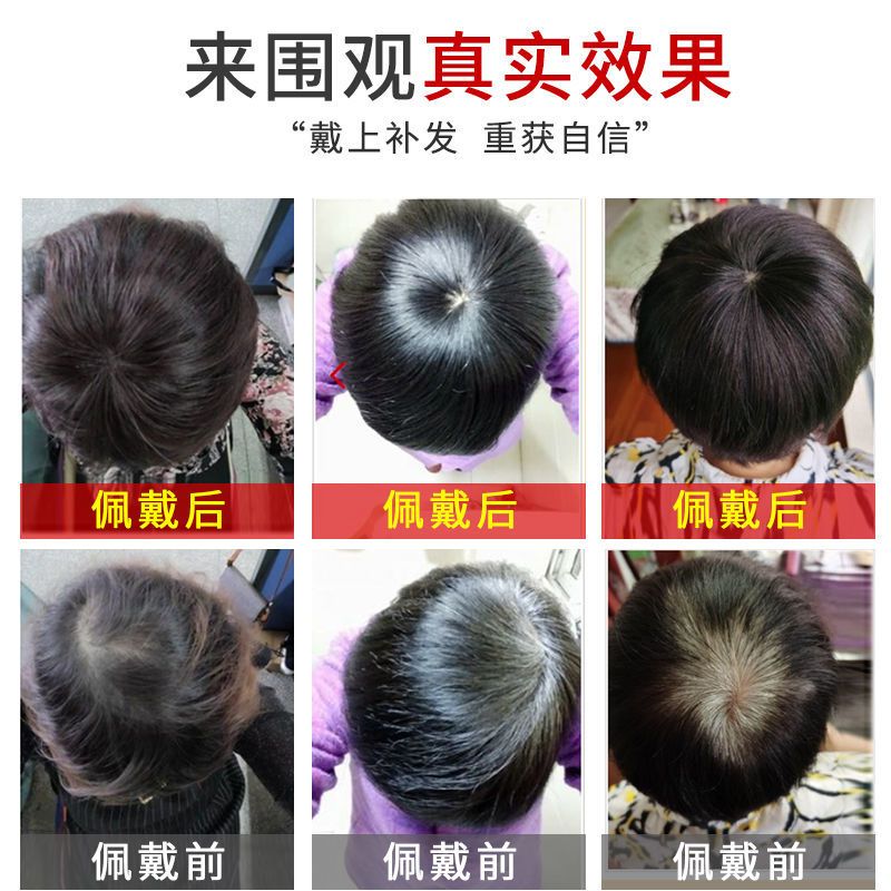 头顶补发片女遮盖白发假发片真人发丝增加发量补发块女一片式无痕 特价款-浅棕色[适用于局部补发者]