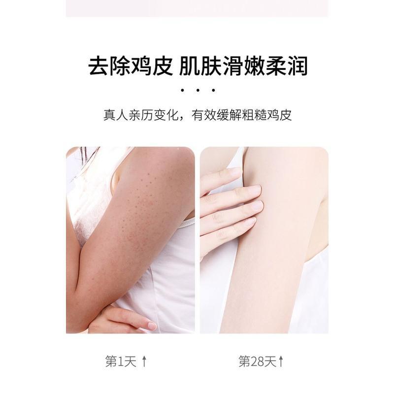嫩白全身果酸分装去鸡皮去角质死皮变亮白女同款沐浴。