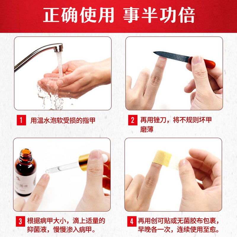 修正灰指甲专用液除灰趾甲液清灰甲非药足部护理用品 [30ml抑菌液+锉刀+创口贴]套装/两盒