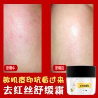 臻养面霜重整霜修护过敏去红血丝痘印痘坑肌肤专用护肤品