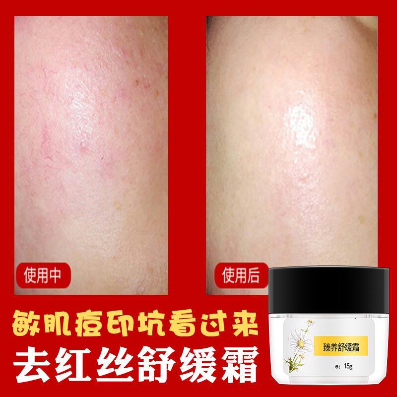 臻养面霜重整霜修护过敏去红血丝痘印痘坑肌肤专用护肤品