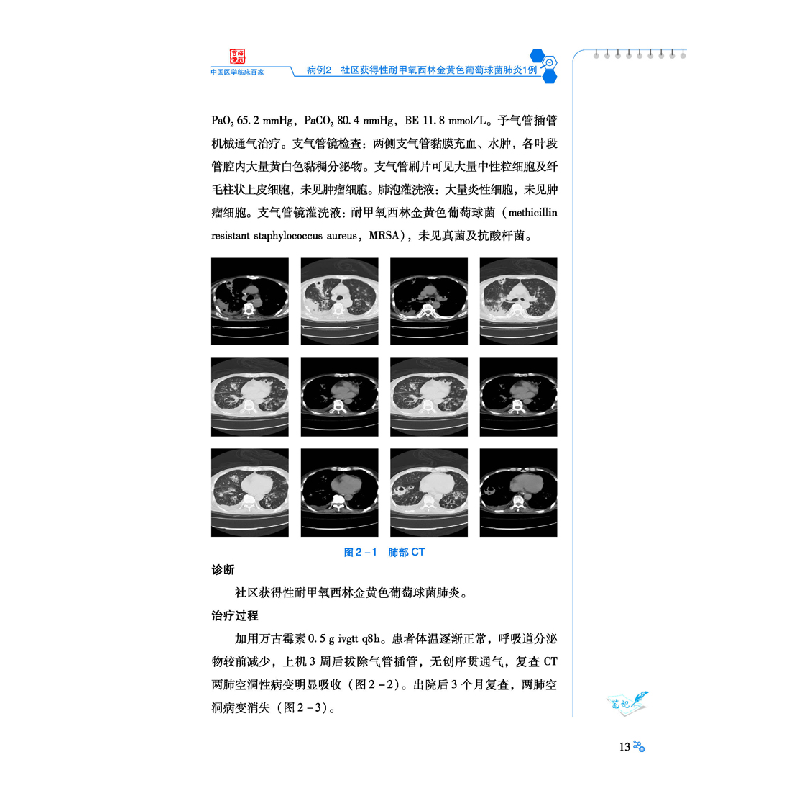 醉染图书向平超教授团队呼吸与危重症疾病病例精解9787518965410高清大图