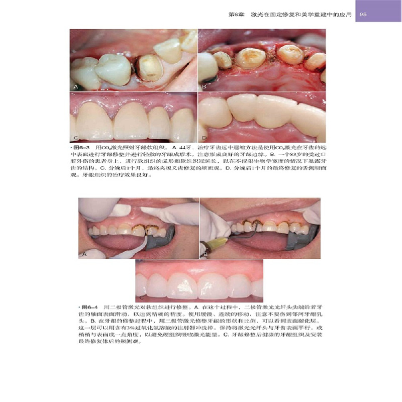 醉染图书老年患者的口腔种植治疗9787559107725高清大图
