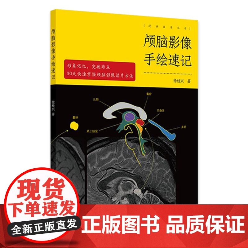 颅脑影像手绘速记 徐桂兴人卫头颅外科神经mri诊断解剖ct读片脑部脑血管重症超声颅内肿瘤图谱放射技术中级人民卫生出版社医