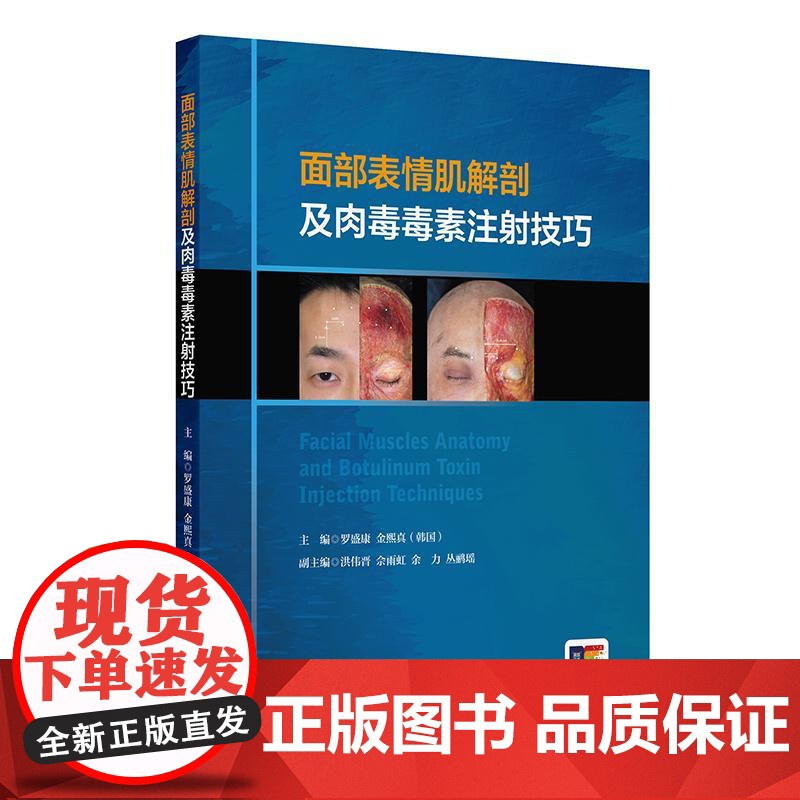 面部表情肌解剖及肉毒毒素注射技巧 附视频 罗盛康 金熙真编 额肌解剖 眉间复合体解剖 提上唇鼻翼肌97871173571高清大图