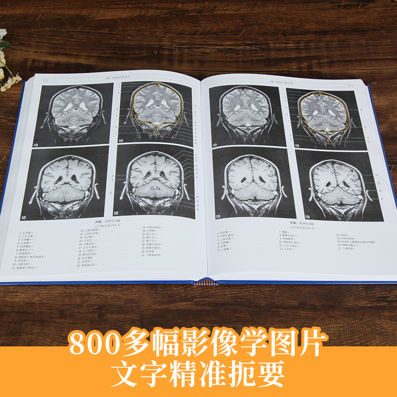 [醉染正版]正版 影像解剖学 影像医学 X线 CT 磁共振 超声波 核素扫描教程 解剖学图谱 影像解剖 影像医学书 丹麦高清大图