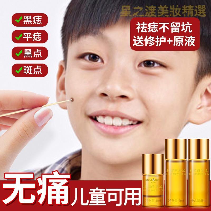 优选好货点痣膏无痕正品祛痣药水金水祛斑去痣神器点斑水脸部黑雀斑点