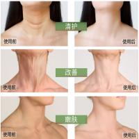 明星同款去颈纹脖子纹美颈霜护颈霜颈部护理颈膜紧致去颈纹颈霜去黑脖子神器女细纹补水提拉去黑色素