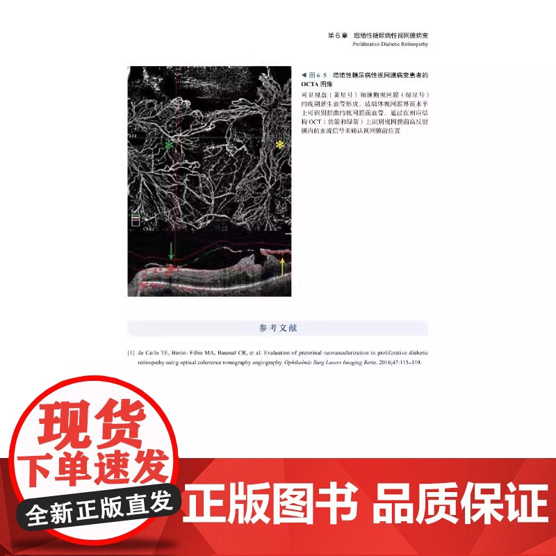 [央视网]眼底病OCT与OCTA 以言简意赅的表达形式对不同眼底疾病的影像特征进行细致描述 并配有丰富的图片资料ZK高清大图