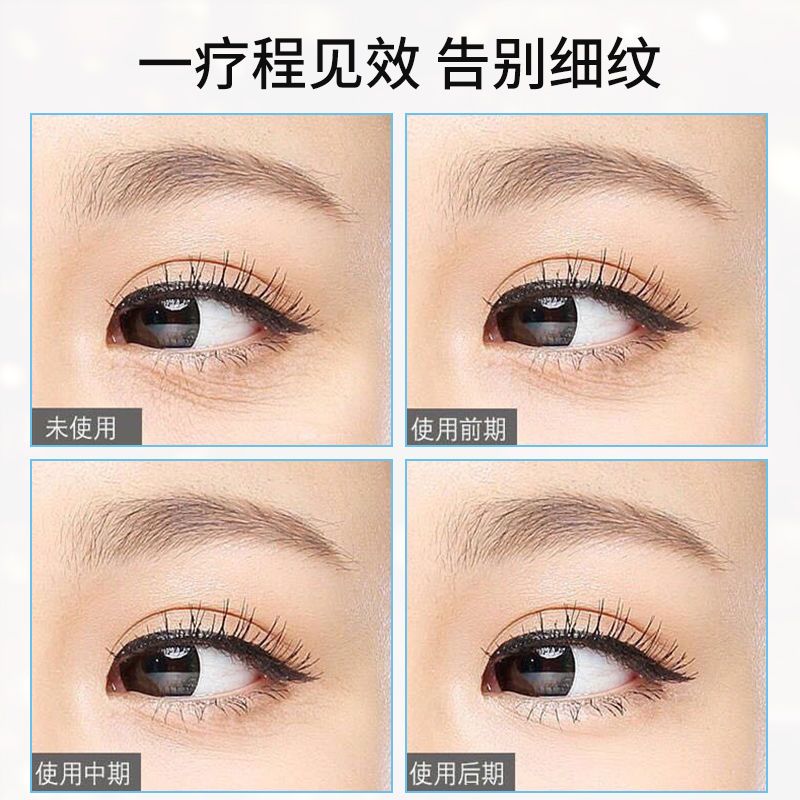 [专业去黑眼圈]眼霜去皱纹去眼袋脂肪粒学生女淡化细纹滋润保湿 多肽活能眼霜 轻度-1瓶装