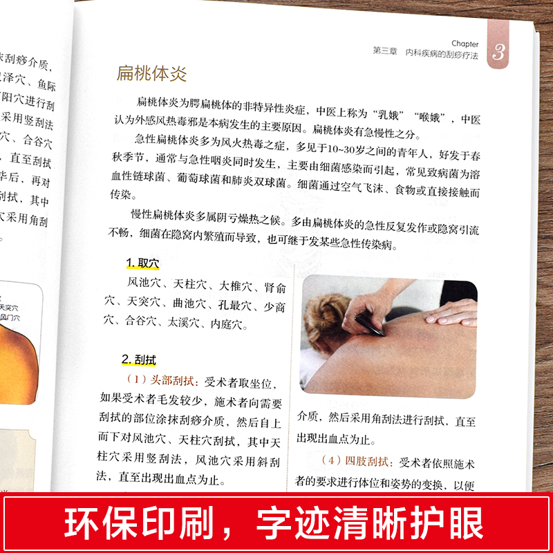 [醉染正版]3册图解艾灸拔罐刮痧一本通图解手法家用人体经络穴位书零基础学会艾灸对症按摩家庭健康保健疗法中医理疗健康养生书高清大图