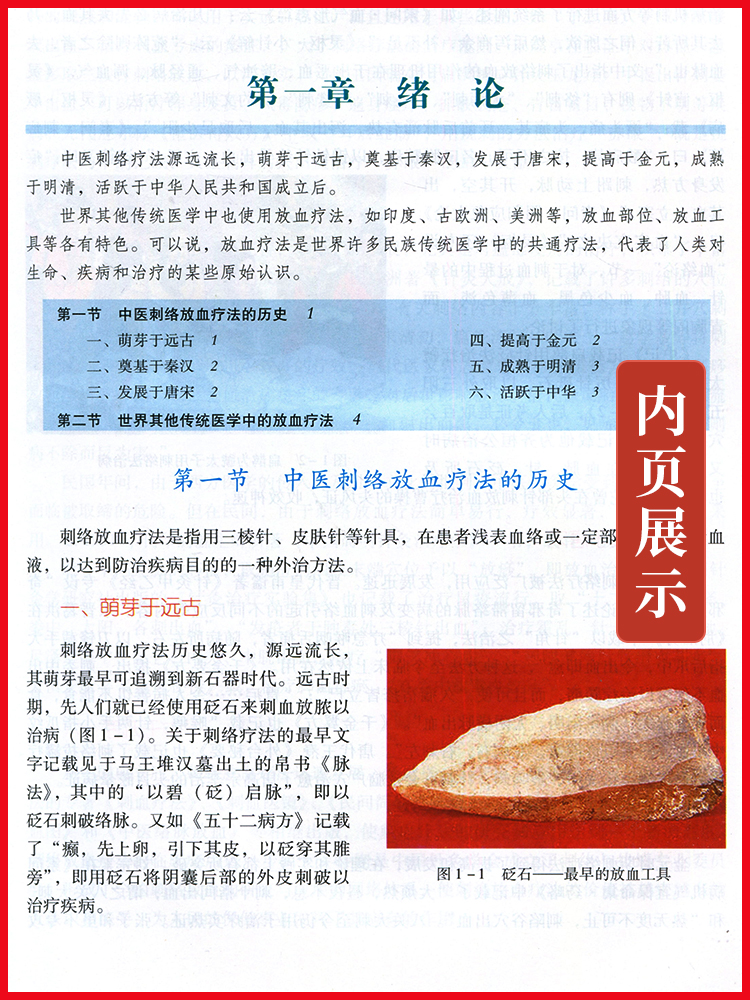 [正版] 中医刺络放血疗法(含光盘)中国针灸学会刺络与拔罐专业委员会 郭义主编 中国中医药出版社 中医刺络放血疗法书籍高清大图