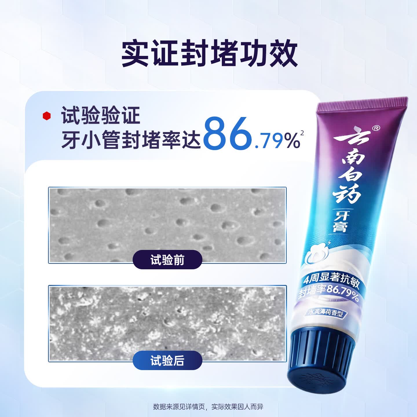 云南白药 牙膏护龈抗敏 水润薄荷香型150g*6支(单位:组)高清大图