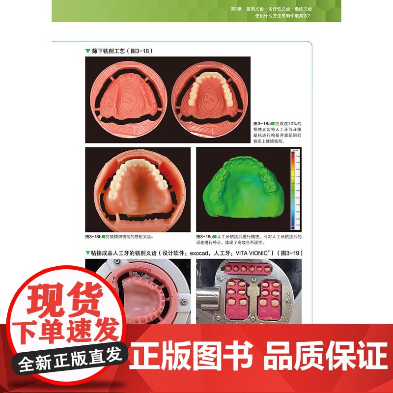 [出版社]数字化全口吸附性义齿新时代 山崎史晃 著 扫描仪和软件差异分析义齿制作方法口腔美容种植 辽宁科学技术出版社高清大图
