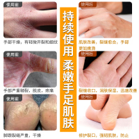 3支装 妍瑟马油清足膏30g*3护足霜滋润营养脱皮汗脚脚气修护改善干裂适用各种肤质男女通用