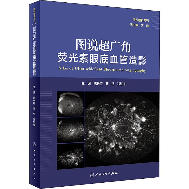 【M】图说超广角荧光素眼底血管造影-9787117314510