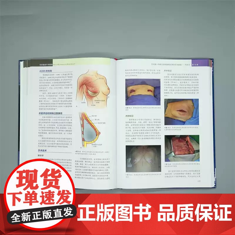乳房重建手术图谱 杜正贵主译 创新乳房重建技术自体组织植入物假体乳房重建整形乳腺外科医生乳房重建手术工具书 zy高清大图