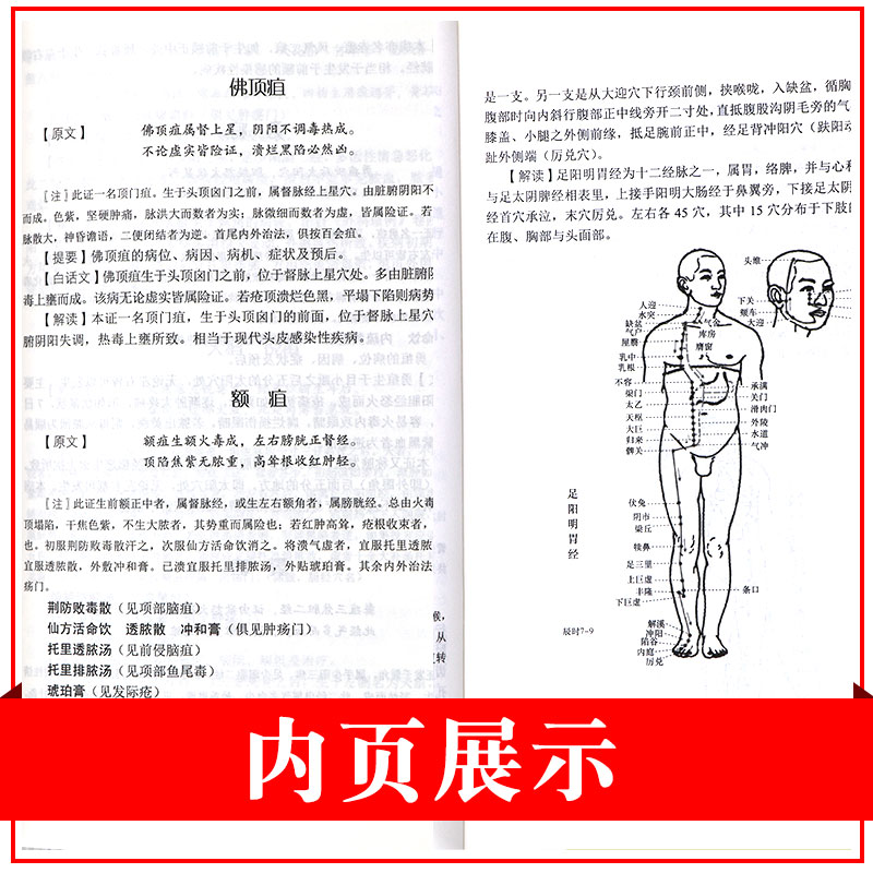 [正版]医宗金鉴外科心法要诀白话解及医案助读(医宗金鉴白话解及医案助读丛书)邹国明 主编 9787521417951高清大图