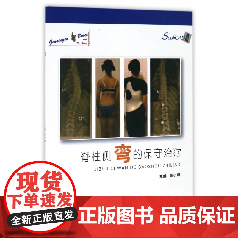 脊柱侧弯的保守治疗高清大图