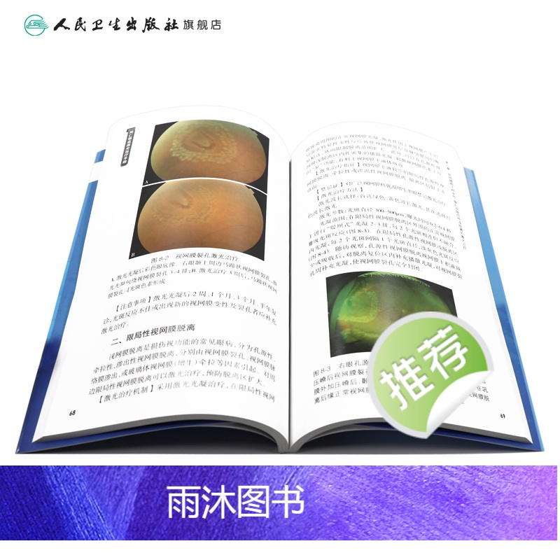 [正版]同仁眼底激光治疗手册(同仁眼科手册系列) 魏文斌,史雪辉 9787117185622高清大图