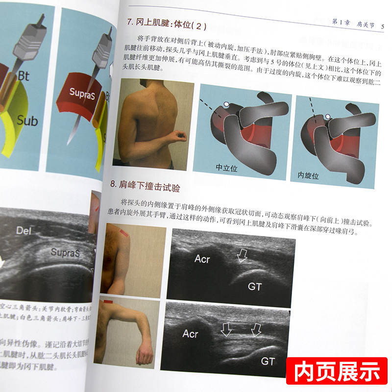 [正版]肌肉骨骼超声技术指南 欧洲肌肉骨骼放射学会超声分会主编 2018年03月出版 平装-胶订 版次1 2018-0高清大图