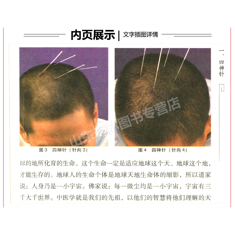 手册 临证配穴法靳三针针灸学中医针灸取穴书籍靳三针疗法>800_800
