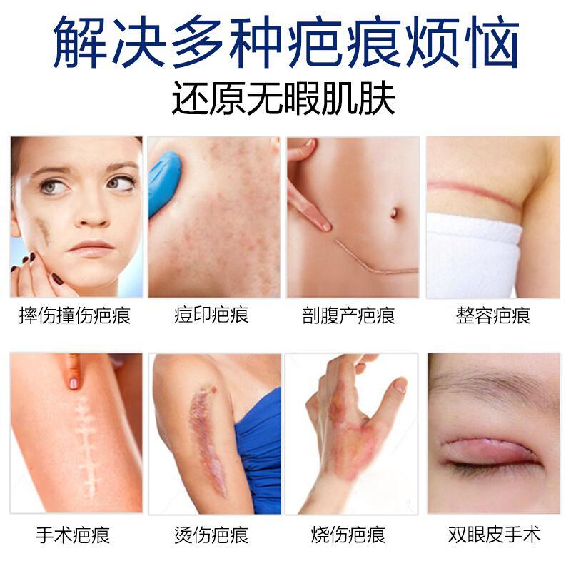 房同款疤痕修复进口疤痕灵去膏手术疤痕伤疤修复凹凸痕刀伤烫伤膏剖腹