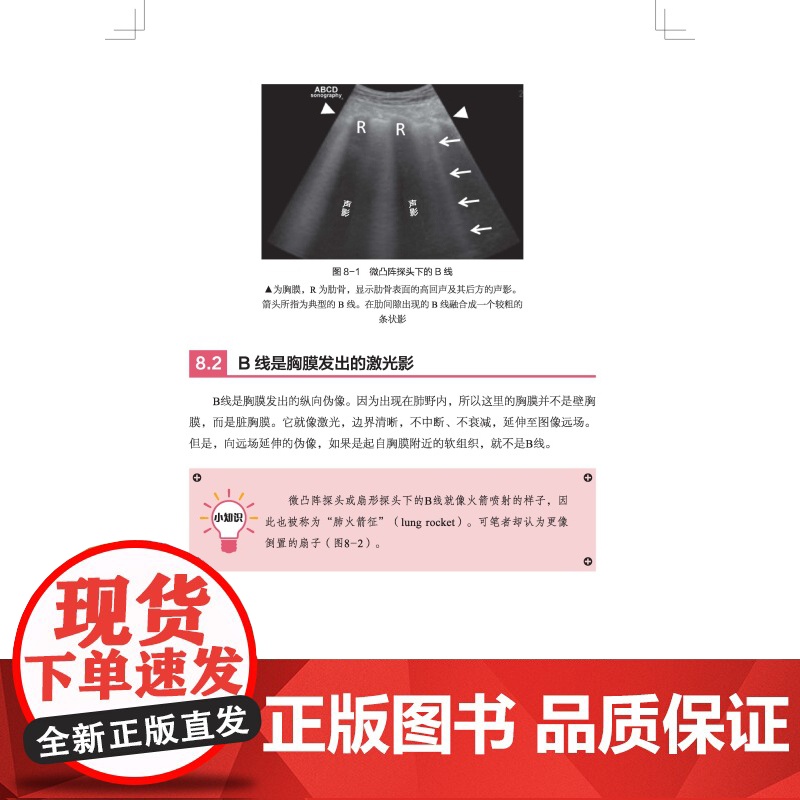 肺部超声 译者 朱强 主任医师 教授 首都医科大学附属北京同仁医院 黄慧莲 主治医师 首都医科大学附属北京同仁医院 北京高清大图