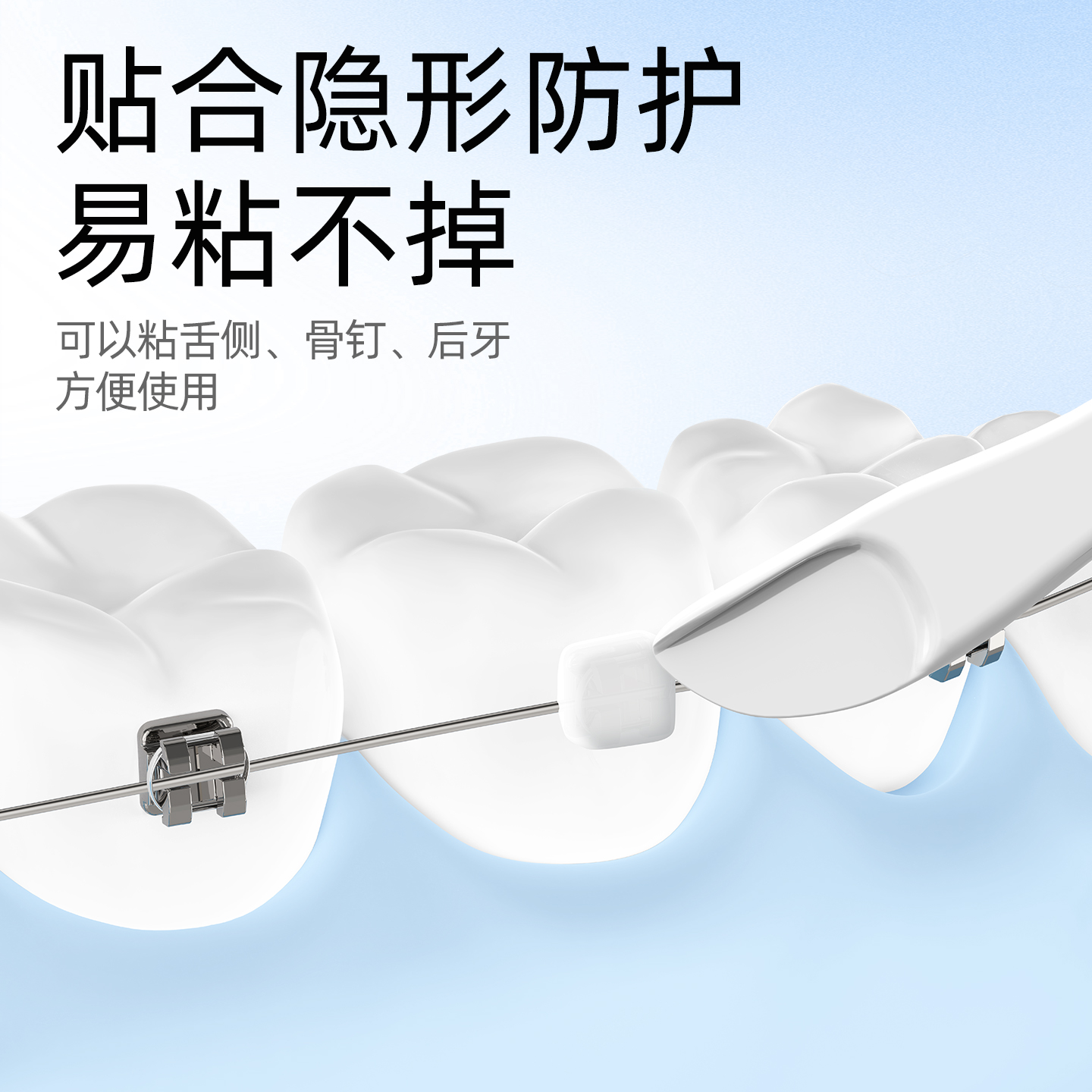 小鹿妈妈正畸保护蜡矫正牙齿专用托槽箍骨钉牙套蜡口腔黏膜防磨嘴高清大图