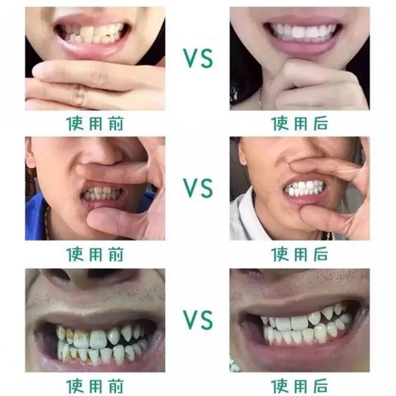 【一刷白】牙齿神器小苏打洗牙粉洁白速效去牙口臭牙斑净