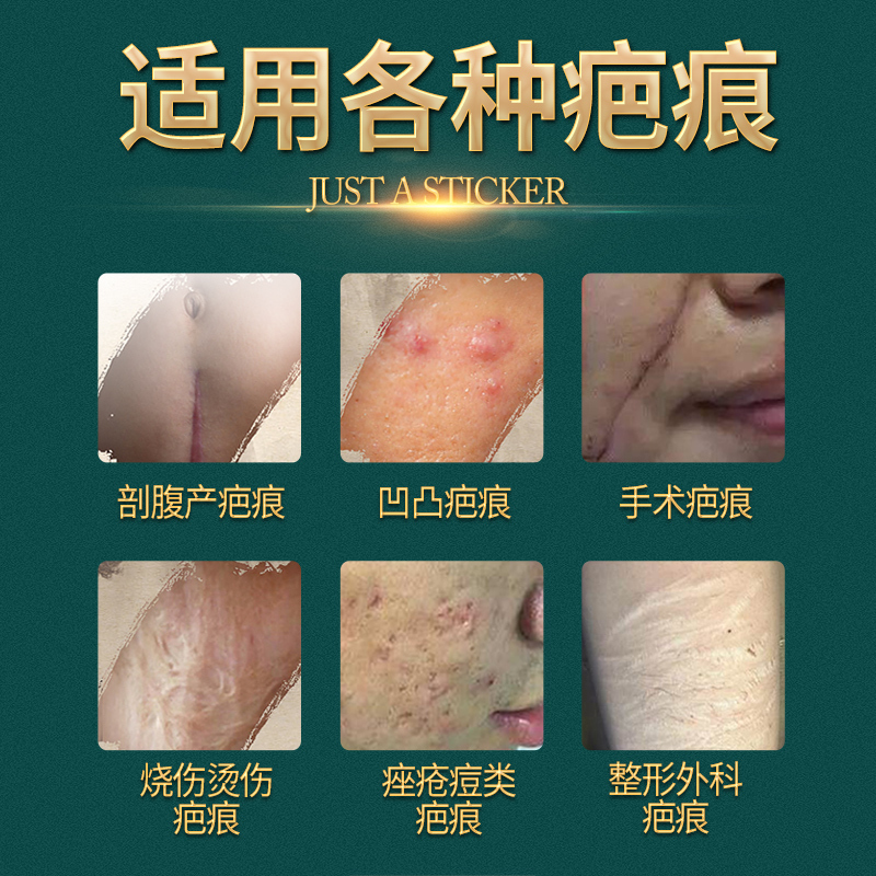 云南白药泰邦疤痕贴凝胶疤痕贴片剖腹产疤痕增生疤痕凹凸疤痕手术疤痕祛疤 5膏