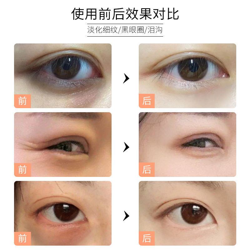 [1盒8片] 缓解眼部疲劳 燕窝酵母眼膜贴去眼袋黑眼圈祛眼袋去眼纹淡化眼细纹去皱补水眼贴