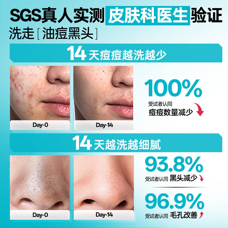 左颜右色 微酸祛痘洗面奶 150g高清大图