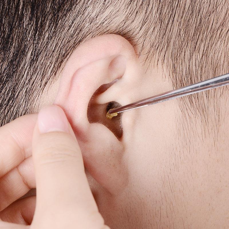 掏耳朵神器儿童耳屎镊子弯柄采耳工具套装技师掏耳勺挖耳勺弯镊子弯