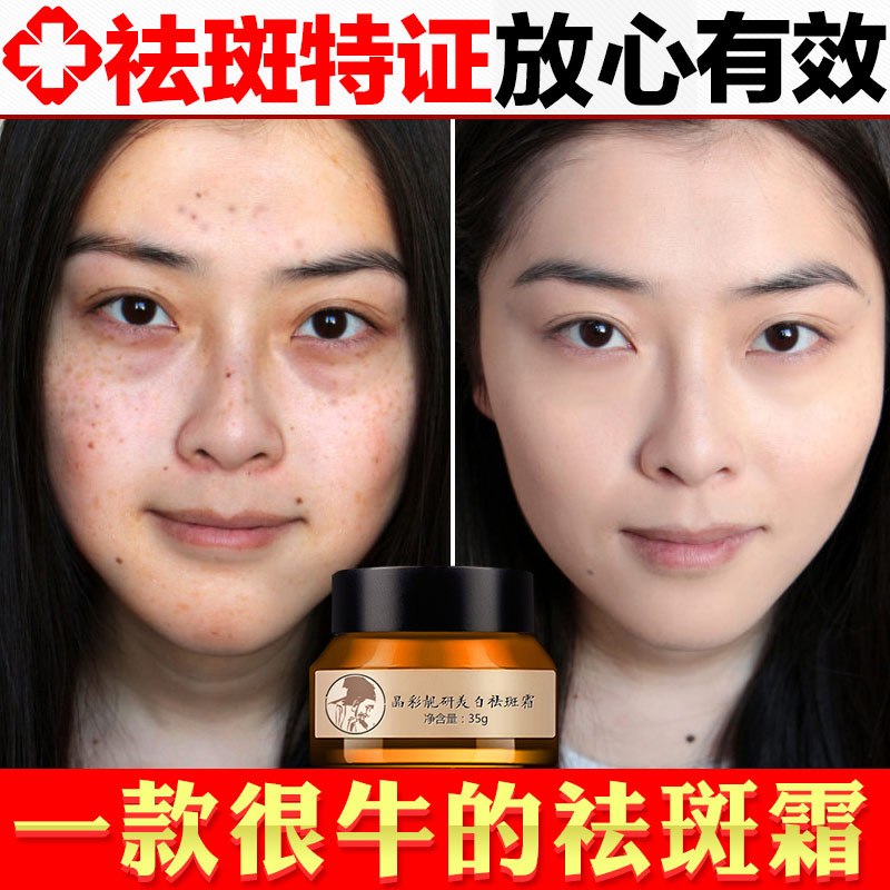 伊芳妮霜男女士 老年斑 遗传斑 色素化妆品补水保湿护肤品
