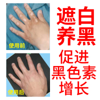 白癜風克星白斑遮盖液外用持久防水修复肤色遮瑕膏纹身黑色素