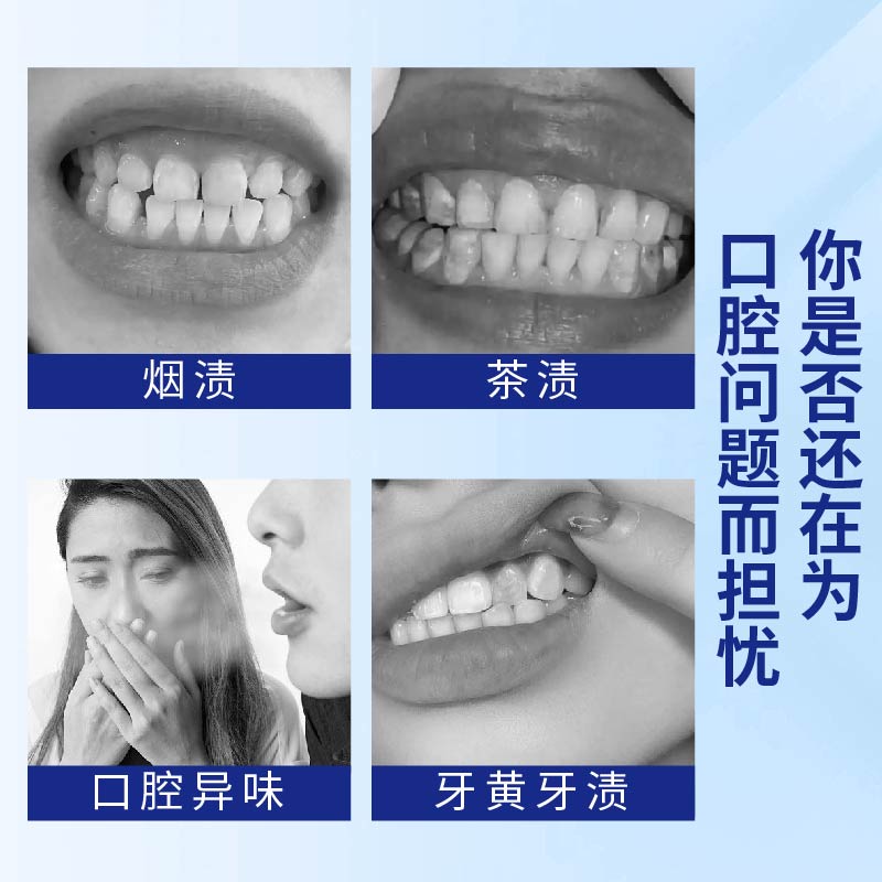牙结石口腔喷雾去口臭去黄溶解牙垢牙渍烟渍异味清新口气高清大图
