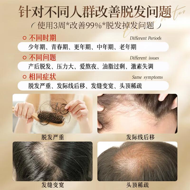 儒意防脱固根洗发水500ml高清大图