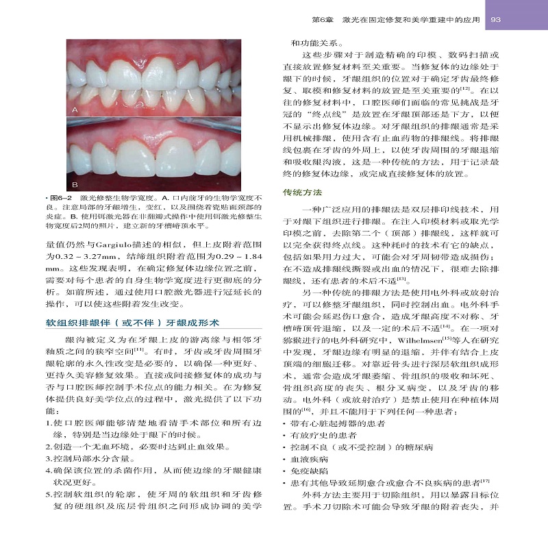 单本全册 [正版] 口腔激光原理与技术实践 第2版 激光技术口腔应用 牙周病牙体牙髓口腔修复种植正畸颌面外科临床口腔医学高清大图