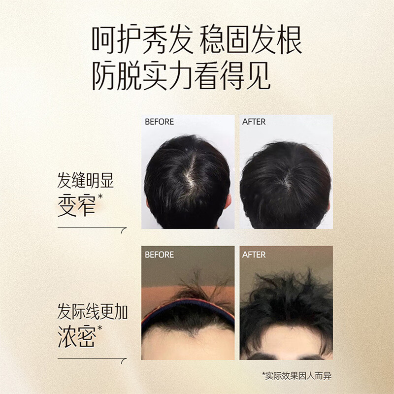 养元青强根健发防脱洗发乳500ml高清大图
