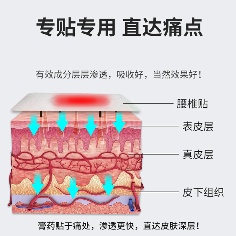 修正腰间盘突出专用膏药膏贴坐骨神经贴膏腰疼腿疼屁股疼腰椎贴
