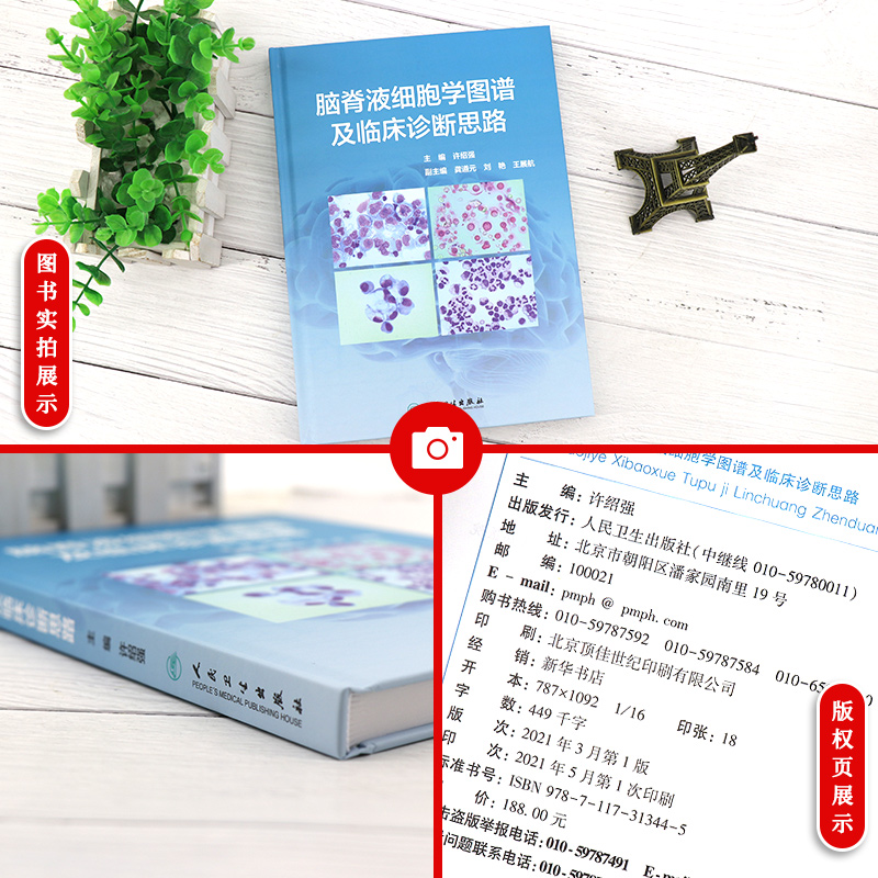 [醉染正版]脑脊液细胞学图谱及临床诊断思路许绍强 浆膜积液脑脊液检验诊断神经系统疾病鉴别诊断学脑静脉疾病医学症状诊断学临高清大图