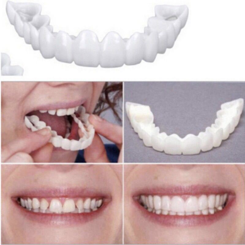 门牙遮盖假牙第四代上牙套[大牙无洞款]有什么不懂的一定要咨询客服哦